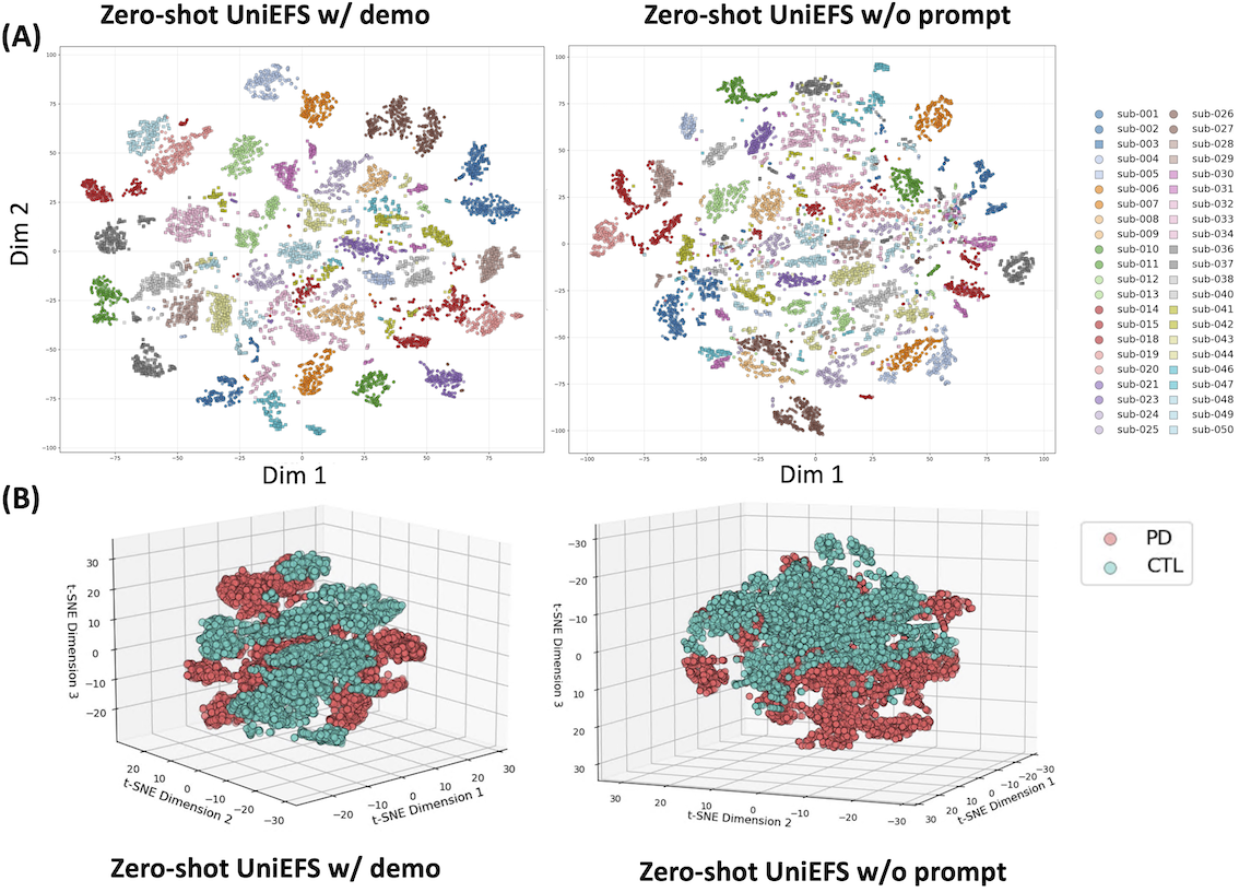 Zero-shot EEG latent embeddings on the Parkinson's disease dataset visualized with t-SNE.